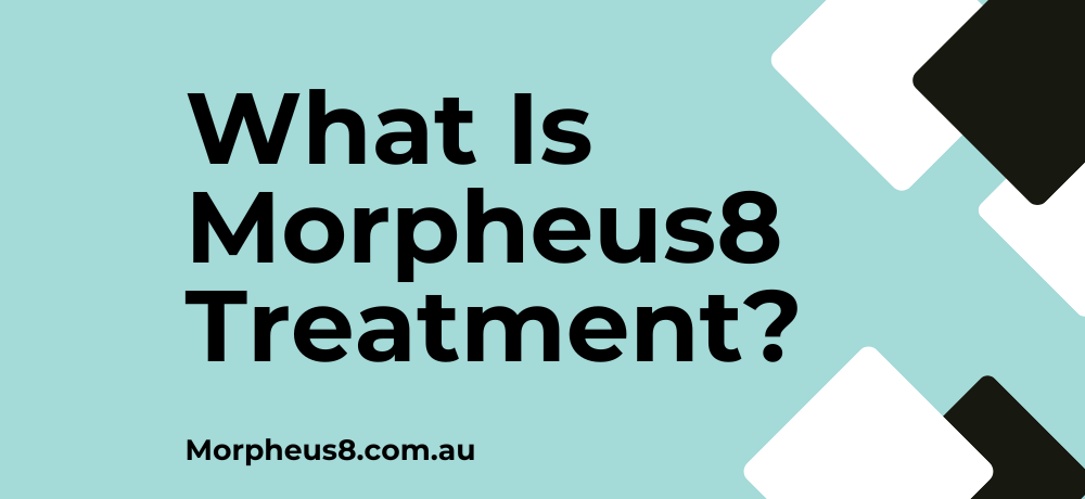 What is morpheus8 treatment rf microneedling explained